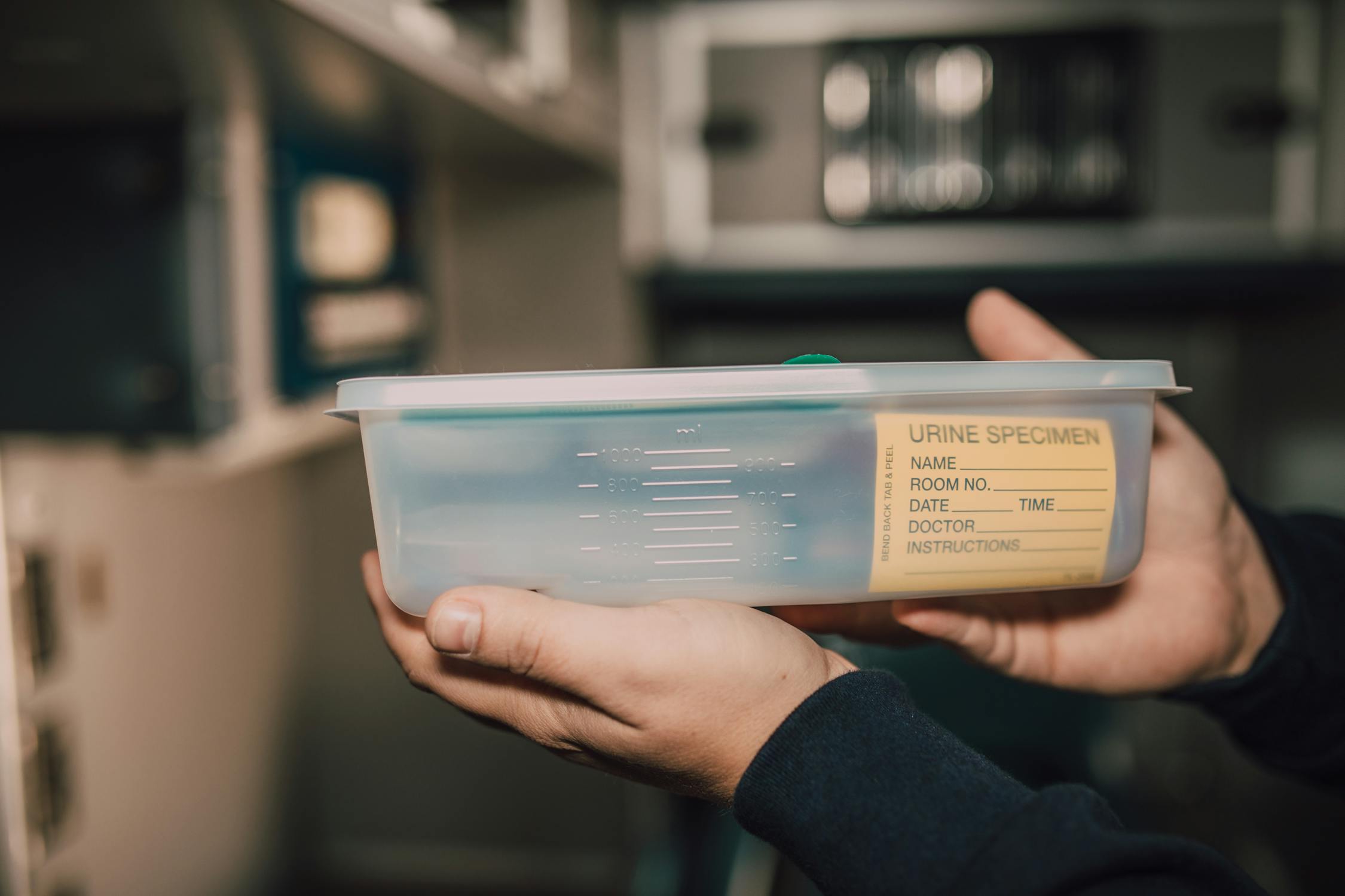 Mycotoxin Testing: Hair vs. Urine vs. Blood — Which Method Is Most Accurate?